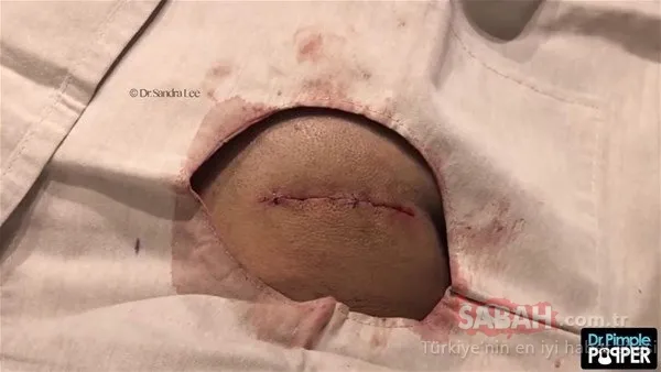 Doktora bu halde geldi! Sonrasındaysa...