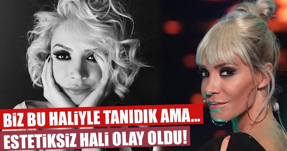 Iste Oyku Serter In Estetiksiz Hali Magazin Haberleri