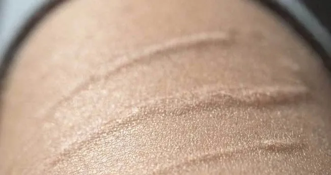 koldaki asi izi bellona koltuk takimi