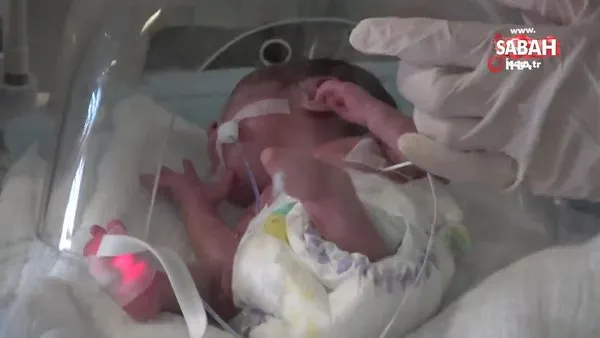 Parmak bebek ayaksız olarak dünyaya geldi | Video
