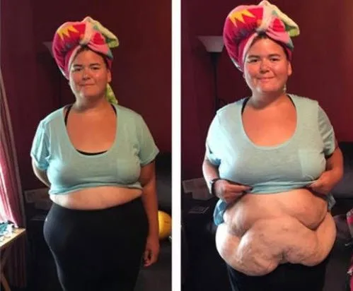 100 kilo verdi şimdi görenler güzelliğine hayran kalıyor!