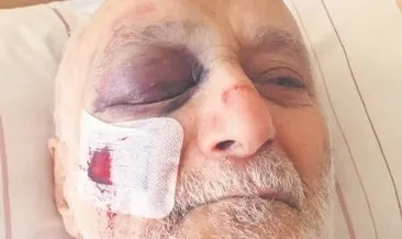 Cami önünde ırkçı dayağı