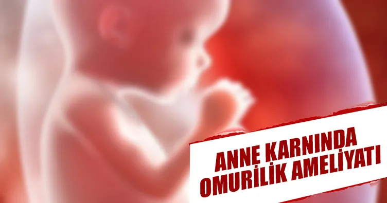 Anne karnında omurilik ameliyatı