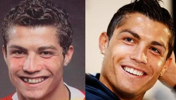 Пластика криштиану роналду фото Пластика криштиану роналду фото