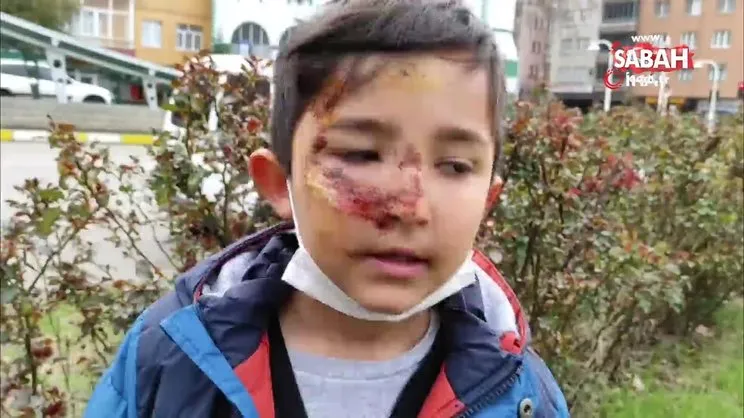 Giresun'da sokak köpeklerinin saldırısına uğrayan çocuk ölümden kurtuldu