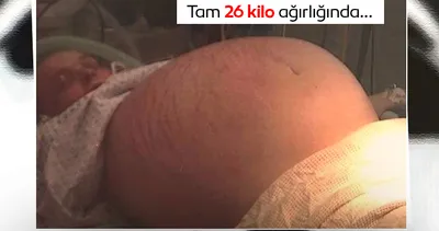 Bebeğini görmek için gitti karnından çıkanlar şok etti! Dünya, doktorların bile inanamadığı bu olayı konuşuyor!