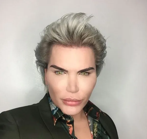 İşte Ken Bebek Rodrigo Alves'in estetiksiz hali