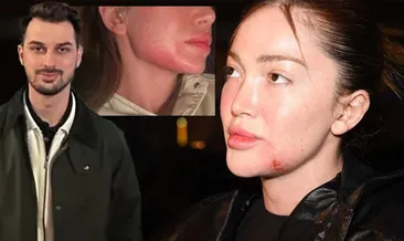 SON DAKİKA… Ölüm tehdidi ve dayak… Fenomen Danla Biliç kabusu yaşamıştı: Berk Çetin hakkında istenen ceza!