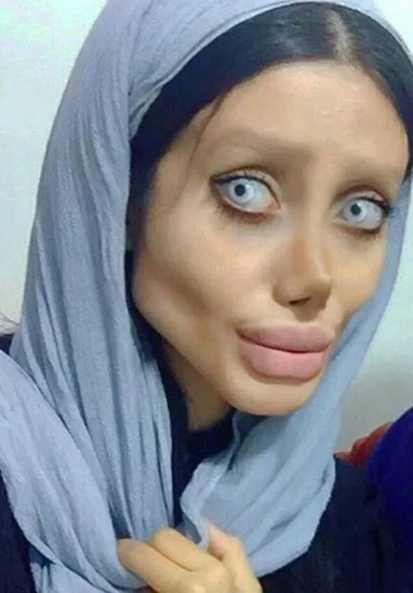 Angelina Jolie olmak istedi son hali korkunç!