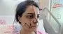 Marmaray İstasyonu’nda saldırıya uğrayan kadın yüzündeki 40 dikişle dehşet dolu anları anlattı | Video