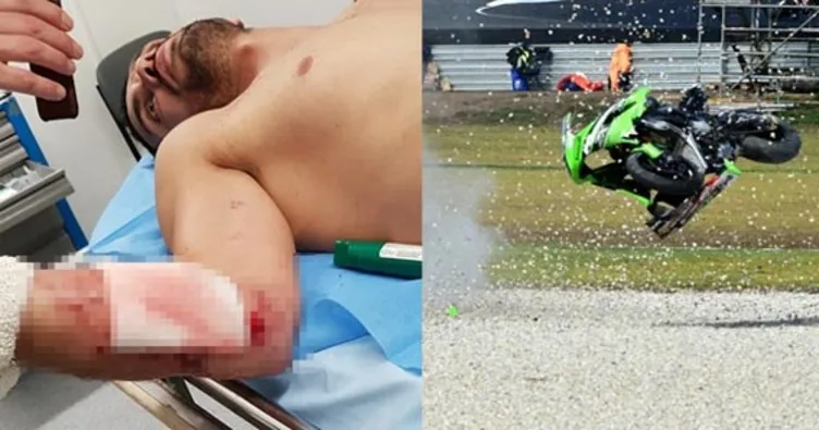 Kenan Sofuoğlu kaza yaptı!