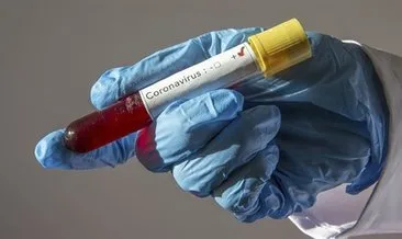 Rusya’da yeni tip koronavirüs vakası 63’e çıktı
