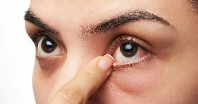 goz alti torbalarina sebep olan ve onleyen besinler guzellik haberleri