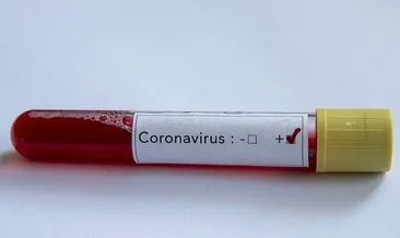 AA’dan önemli duyuru: Corona virüsü yüzünden ölenlerin sayısı her  geçen saat artıyor! Çin’deki Türk öğretmen Burak Teoman’dan son dakika açıklaması!