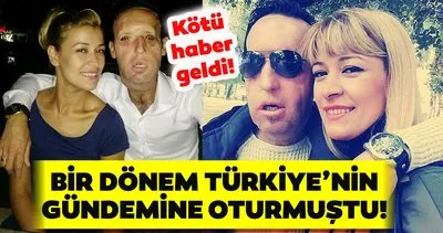 son dakika haberi yuz nakli olan recep sert ten kotu haber esi esma sert ile son dakika haberler