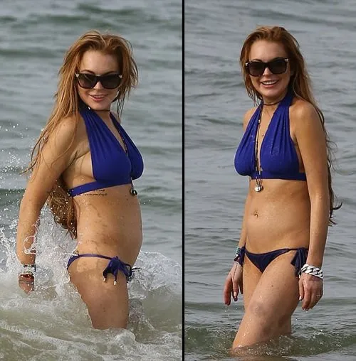 Lindsay Lohan’ın vücudu çürük içinde