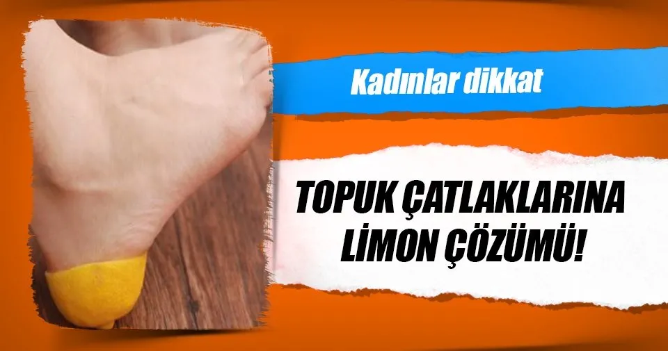 topuk catlagina ne iyi gelir iste topuk catlaklarina dogal cozum kadin haberleri