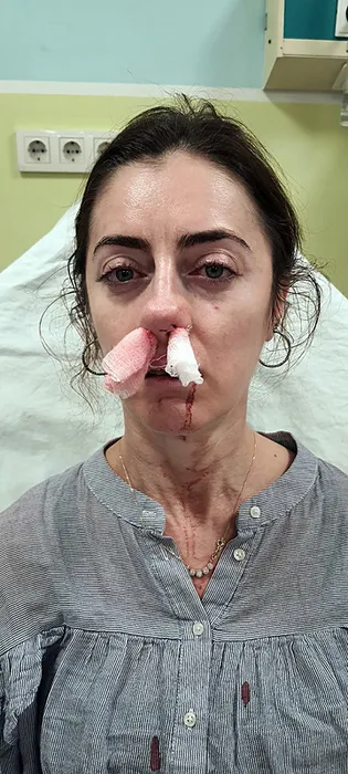 SON DAKİKA... Eşinin sevgilisi sandığı kadını öldüresiye darp etti: Ağzımdan burnumdan kan gelmeye başladı…