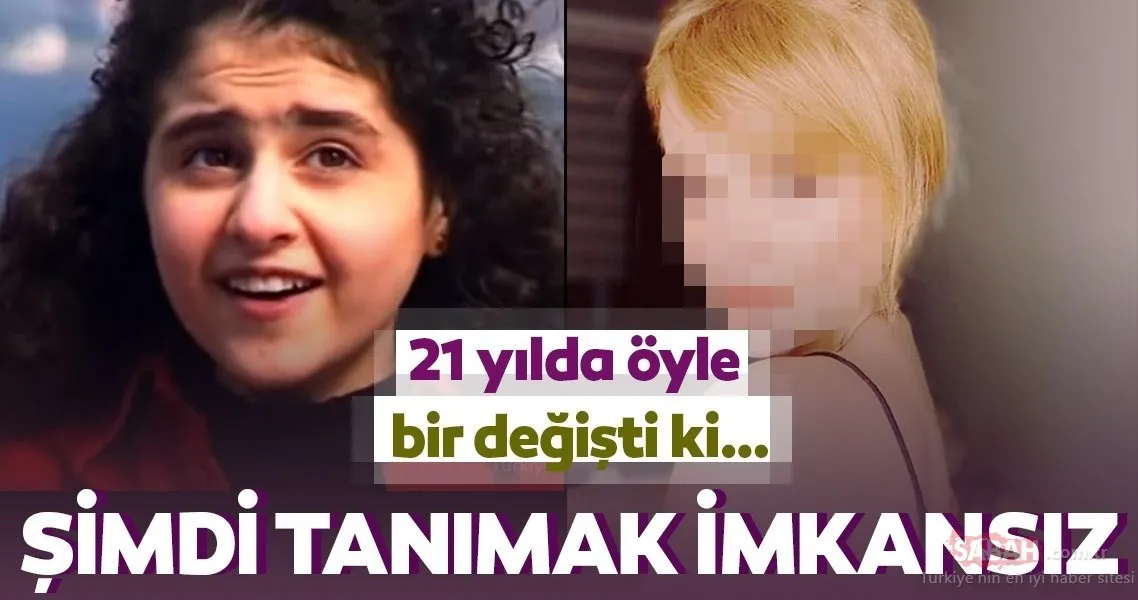 Azeri kızı Günel estetiğin dozunu fazla kaçırdı! Günel Zeynalova 21