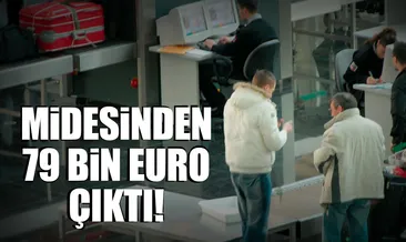 Midesinden 79 bin euro çıktı