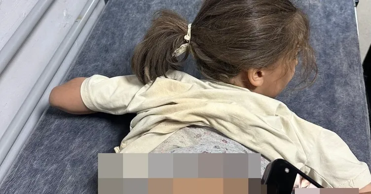 7 yaşındaki Zeynep 3 köpeğin saldırısına uğradı: Kanlar içinde kalan küçük kız tedavi altında!