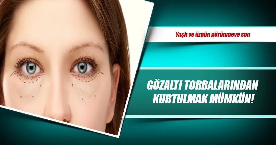 Gozalti Torbalarindan Kurtulmak Mumkun Kadin Haberleri
