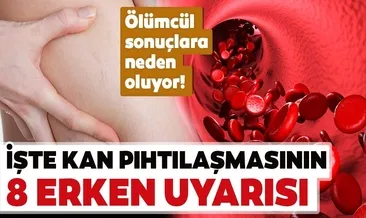 Kan pıhtılaşmasının 8 erken uyarısı