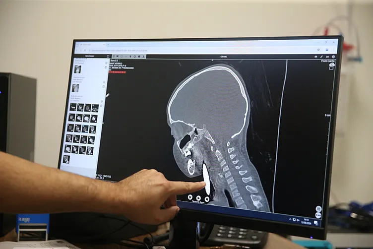 Mersin’de korkutan olay: Şah damarına 2 cm kalmıştı!