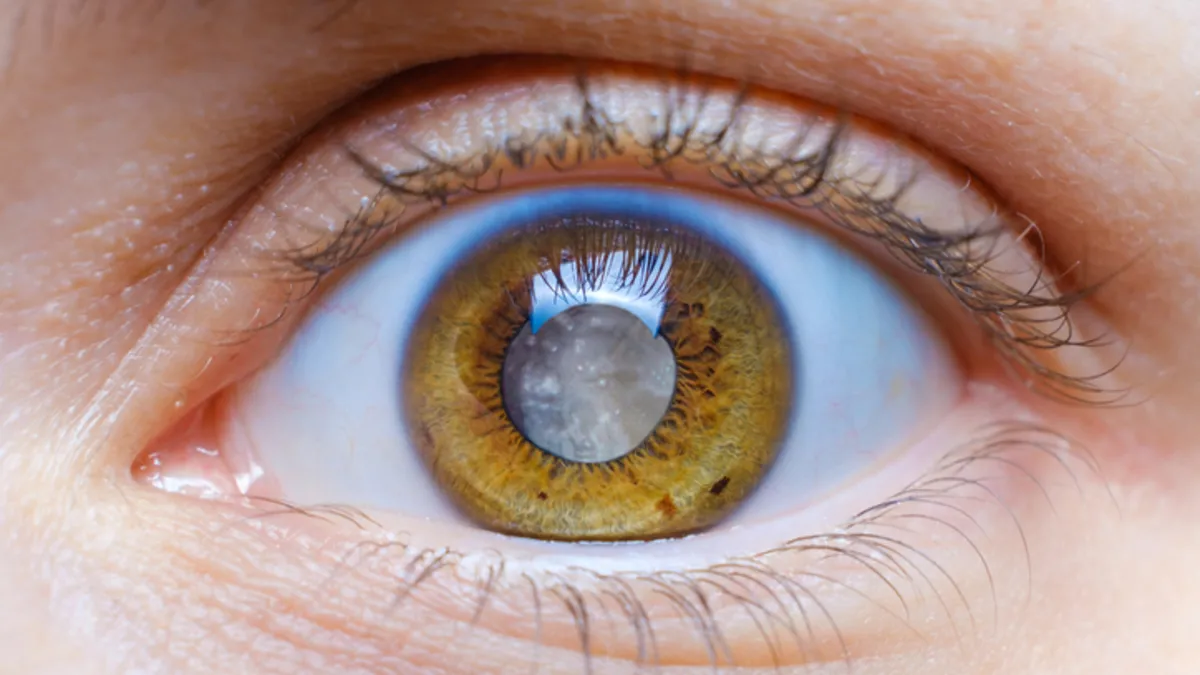 Milyonlarca kişi habersiz: Görme kaybı kapıda bekliyor! Milyonlarca kişi habersiz: Görme kaybı kapıda bekliyor!