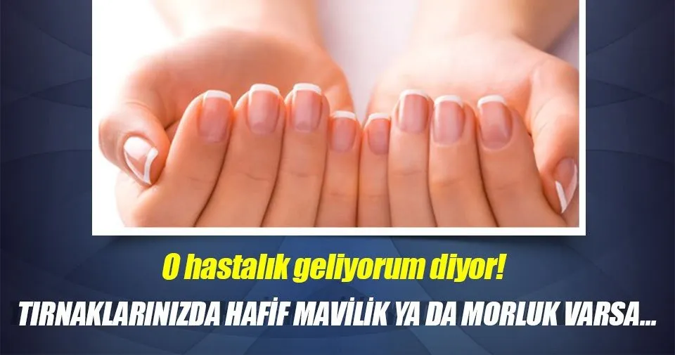 Tırnak yeme alışkanlığı nasıl bırakılır Tırnak yeme alışkanlığı nasıl bırakılır