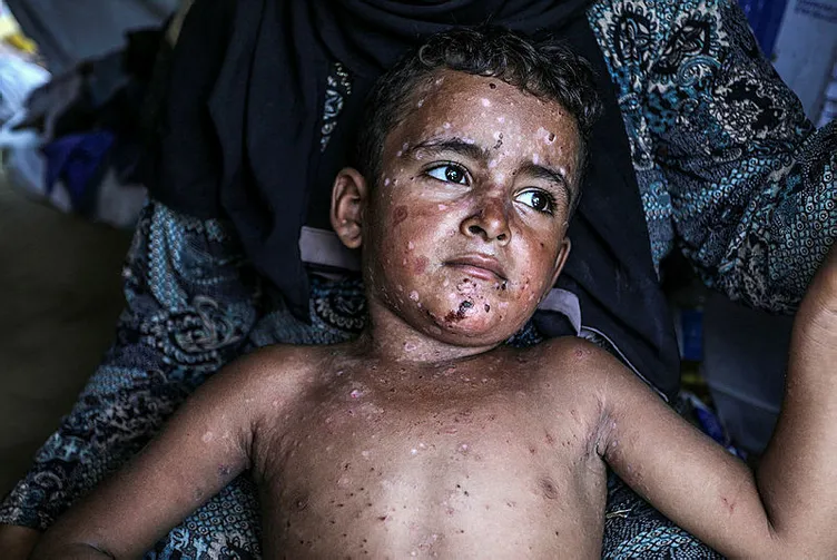 BM Gazze’deki soykırım boyutunu gözler önüne serdi! En ağır bedeli çocuklar ödüyor