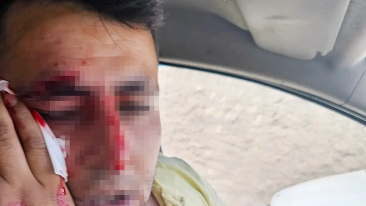 Kontrol ekibine 30 kişilik grup saldırdı! Çalışanları darp eden 2 kişi tutuklandı Kontrol ekibine 30 kişilik grup saldırdı! Çalışanları darp eden 2 kişi tutuklandı