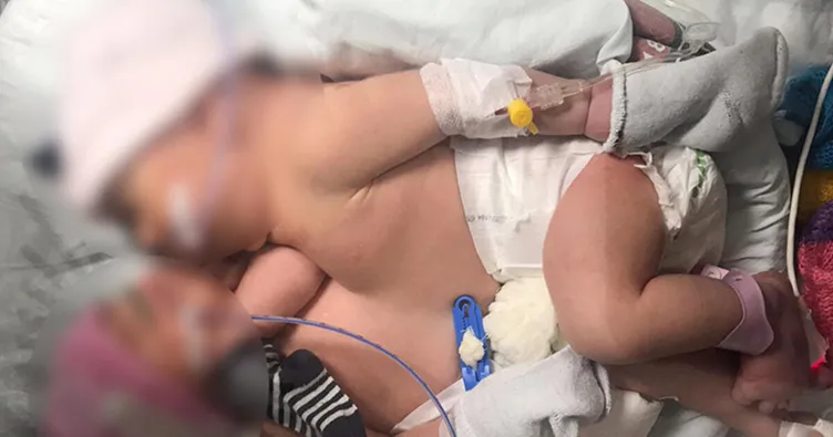 Elif bebek hayatını kaybetti