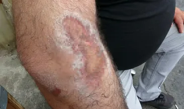 Korku filmlerini aratmayan kapkaç