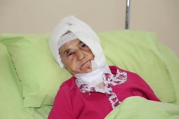 Rize’de ayının saldırısına uğrayan yaşlı kadın ağır yaralandı