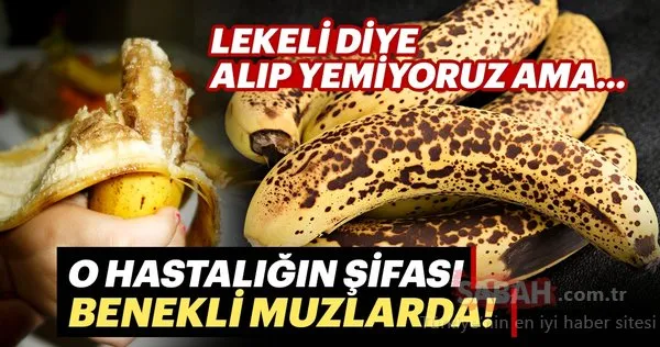 Lekeli diye alıp yemiyoruz ama... O hastalığın şifası benekli muzda!