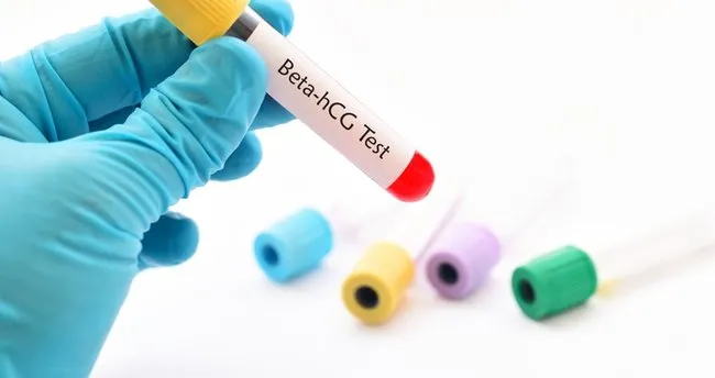 4 haftalık gebelikte beta HCG değeri kaç olmalı? Beta hCG ne zaman artar?