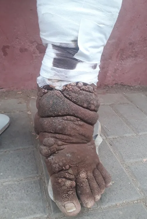 Bir sabah uyandığında bacağını böyle buldu!