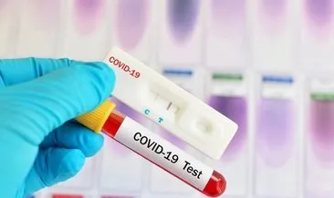 Koronavirüs test sonucu sorgulama nasıl yapılır? Koronavirüs test sonucu e Nabız ile kaç günde ve ne zaman çıkar?