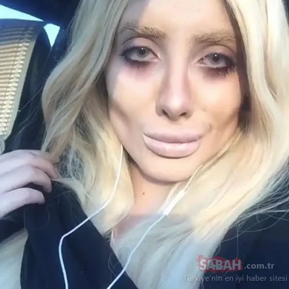 gercekten estetik operasyon gecirdi