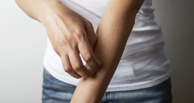 Eczanede Ilac Bulamayanlar Evde Yapsin Bitkisel Uyuz Ilaci Tarifi Saglik Haberleri