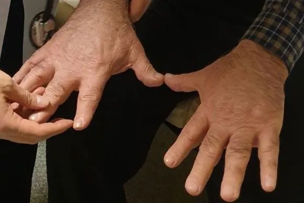 Dili ve elleri her geçen gün büyüyor