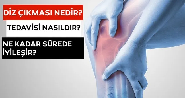 diz cikmasi belirtileri nedir ve