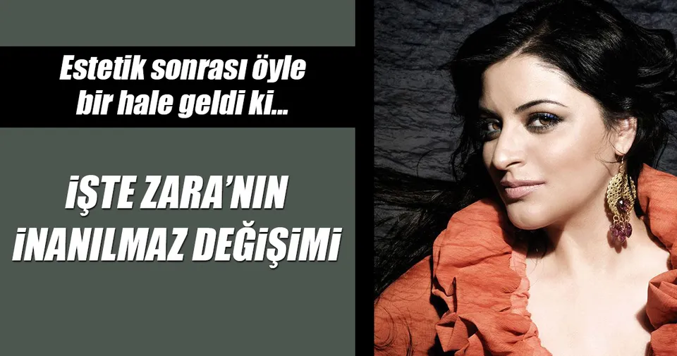 حزام كثير جدا ستيوارد zara estetik mi yaptirdi cazeres arthurimmo com