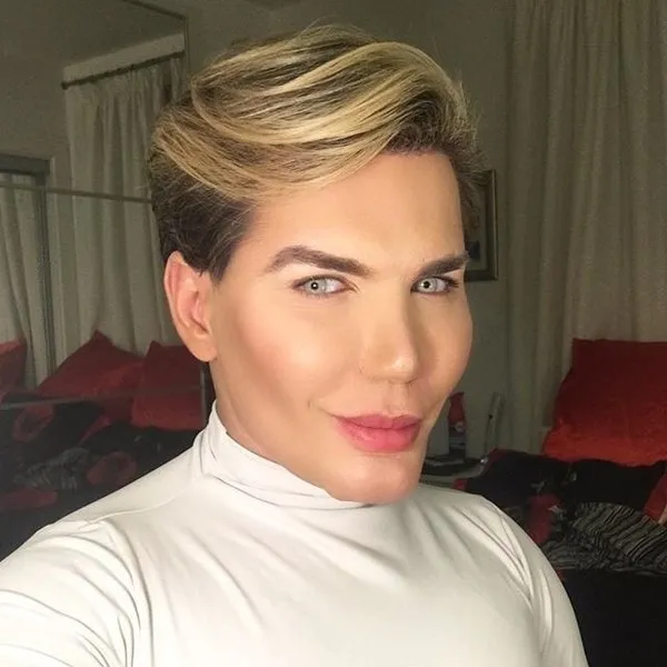 İşte Ken Bebek Rodrigo Alves'in estetiksiz hali