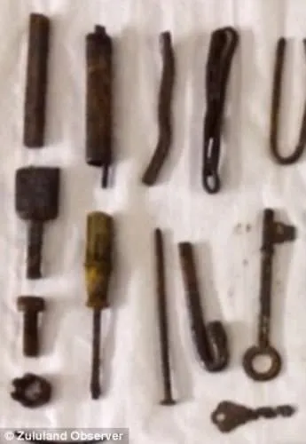 Midesinden çıkanlar doktorları şoke etti