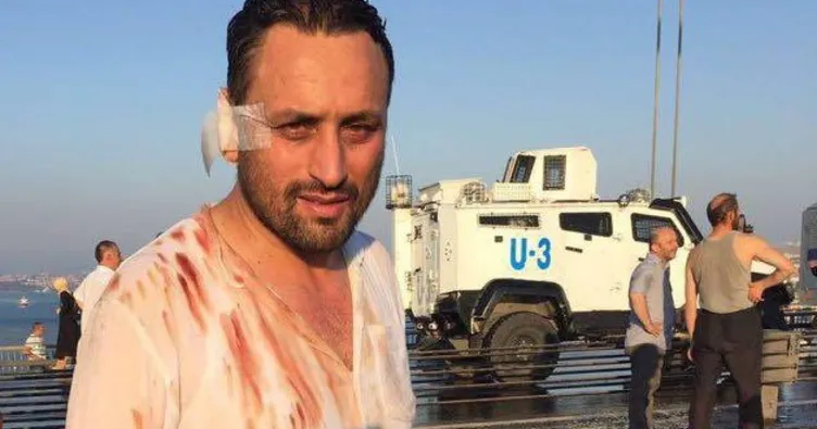 İBB 15 Temmuz Gazisi’ni ekmeğinden etti