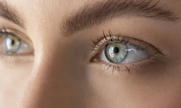 Gözdeki bu belirtiye dikkat! Körlüğün sinyali olabilir...