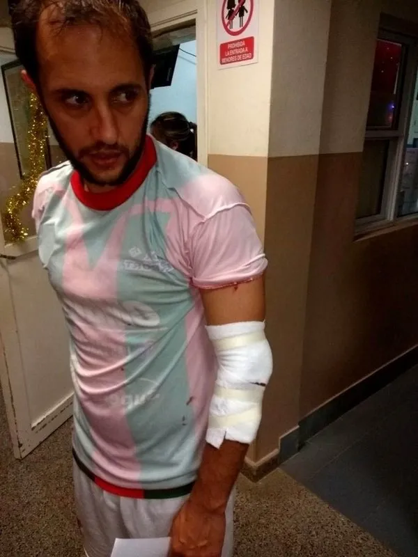 Futbolculara plastik mermi sıktılar!