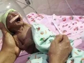 Hindistan’da hasta doğan bebeği anne ve babası terk etti